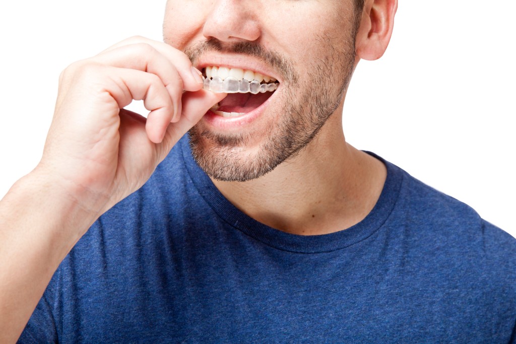 is there an age limit for invisalign?